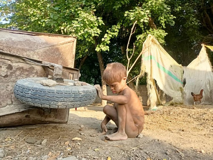 Malnutrition and Poverty: The Story of Shazia and Her Son